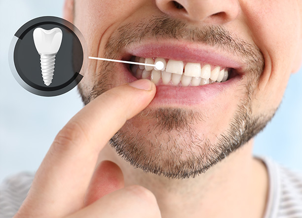 Chadha   Co Dental | Preventative Program, Digital Radiography and Fluoride Treatment